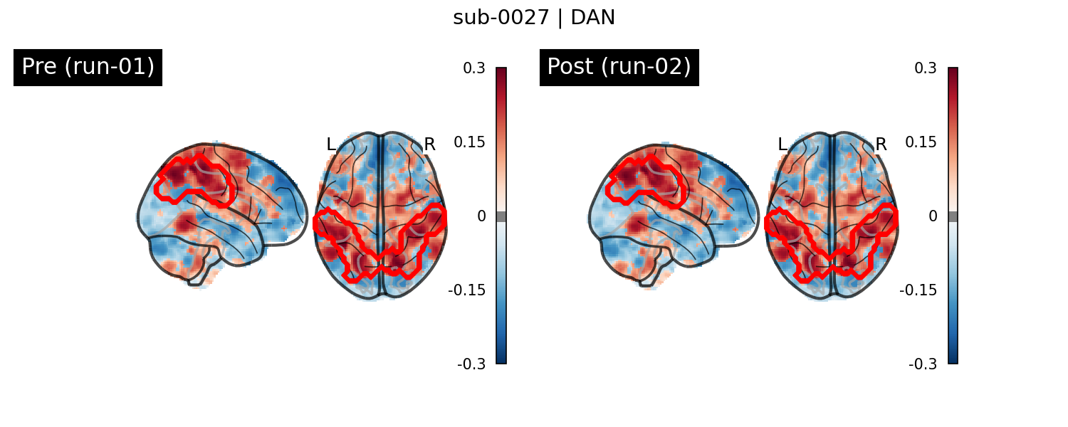 sub-0027_DAN_run-comparison.png