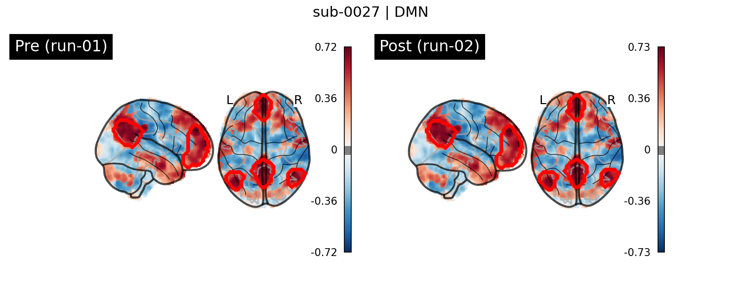 sub-0027_DMN_run-comparison.png