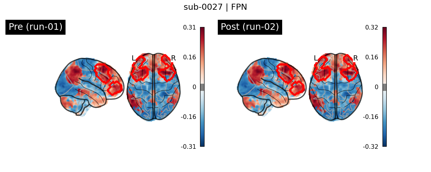 sub-0027_FPN_run-comparison.png