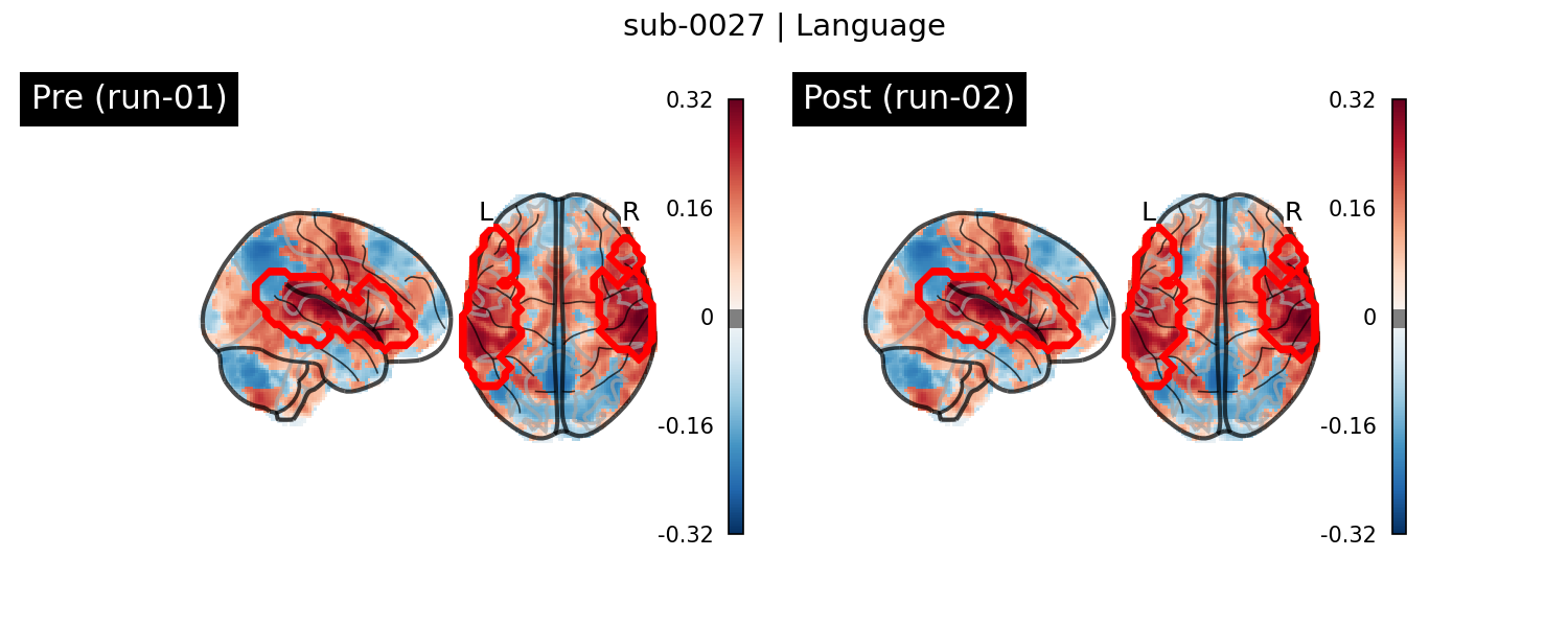 sub-0027_Language_run-comparison.png