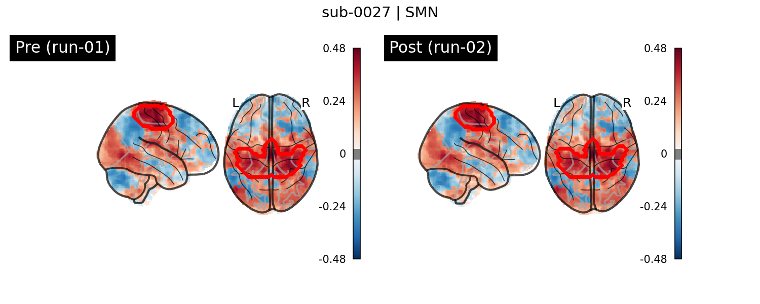 sub-0027_SMN_run-comparison.png