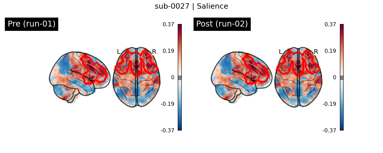 sub-0027_Salience_run-comparison.png