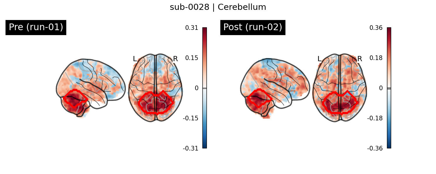 sub-0028_Cerebellum_run-comparison.png