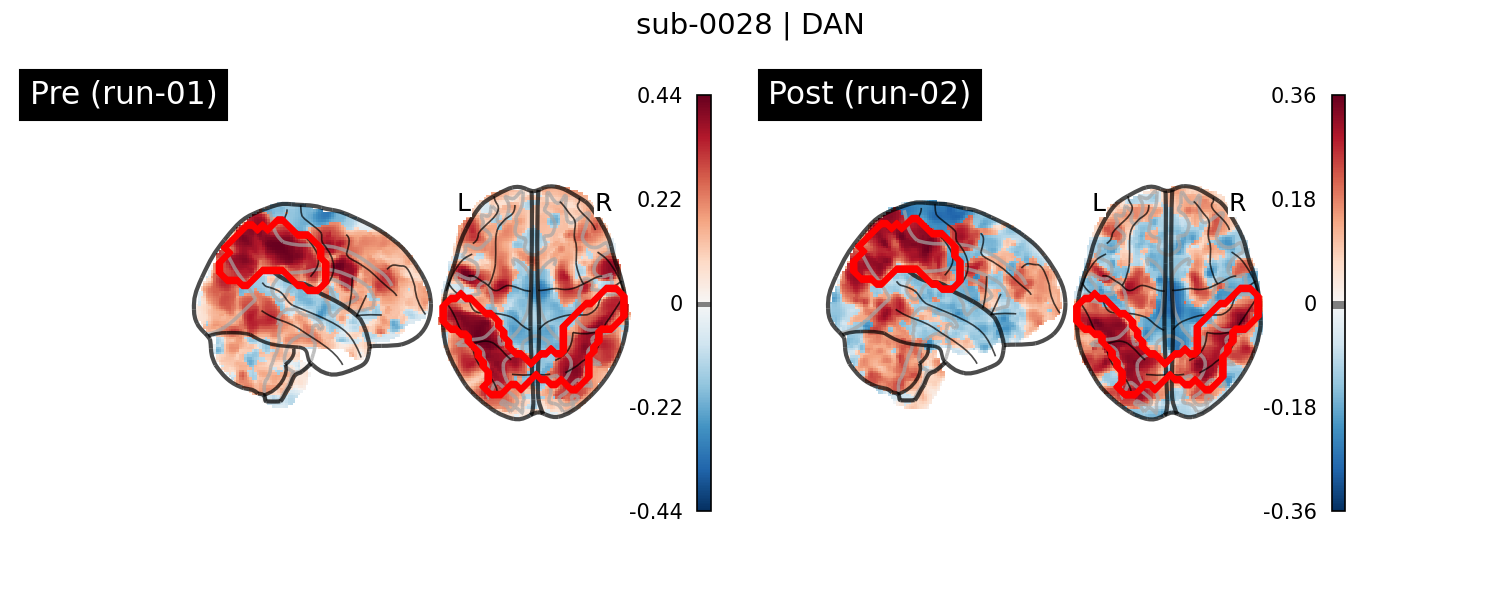 sub-0028_DAN_run-comparison.png