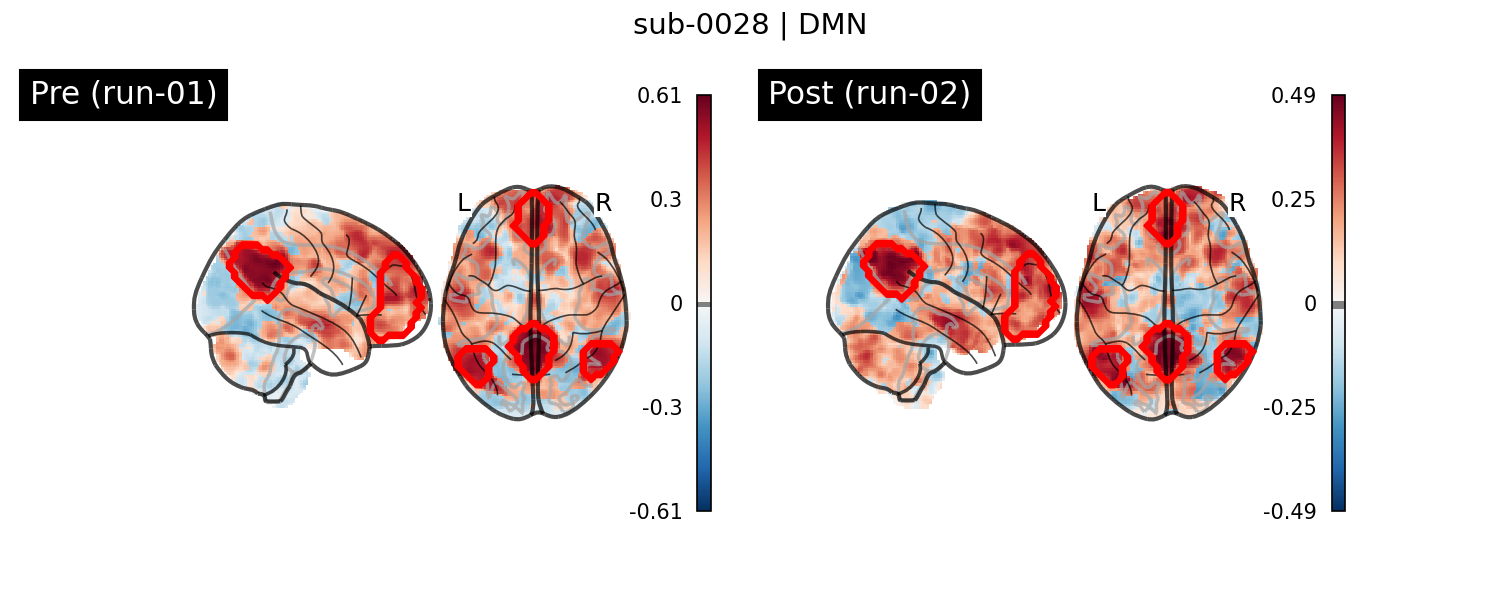 sub-0028_DMN_run-comparison.png