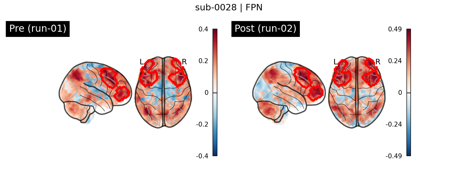 sub-0028_FPN_run-comparison.png
