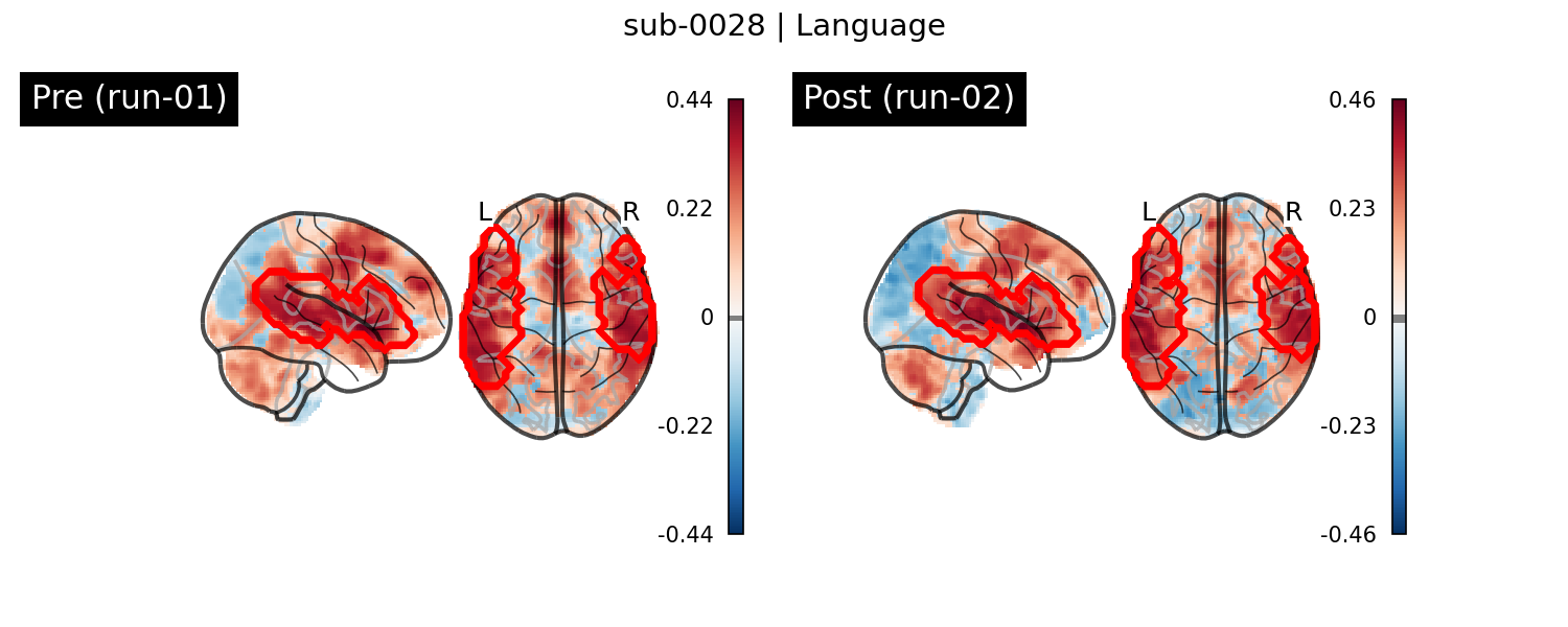 sub-0028_Language_run-comparison.png