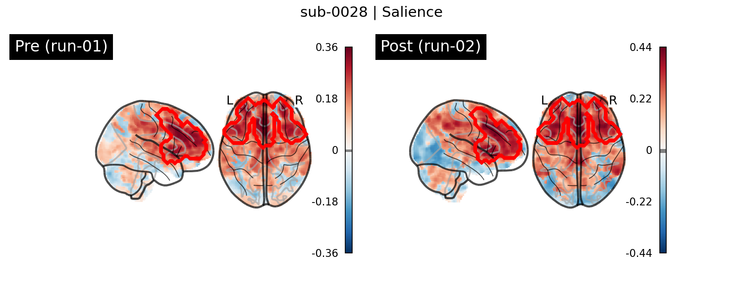 sub-0028_Salience_run-comparison.png