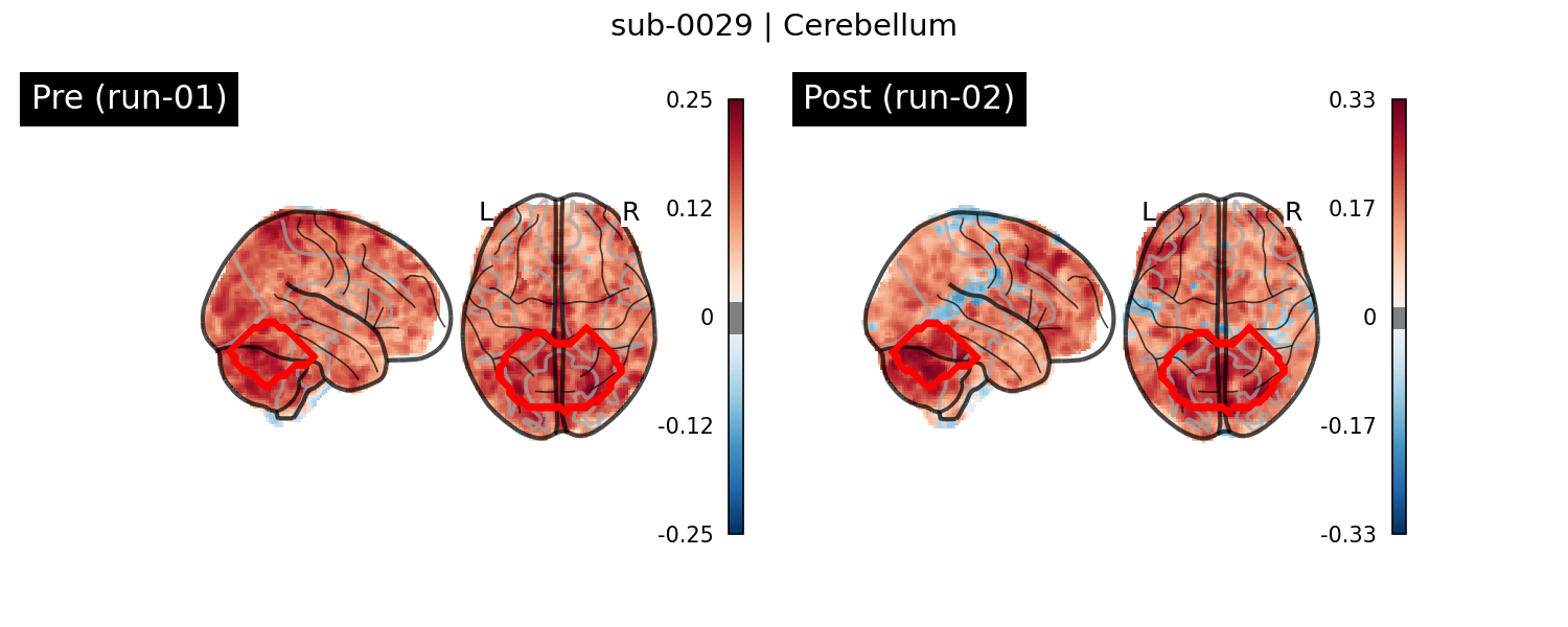 sub-0029_Cerebellum_run-comparison.png