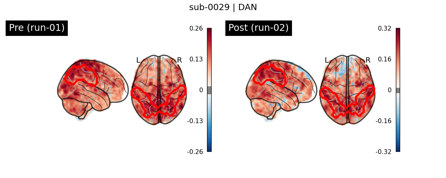 sub-0029_DAN_run-comparison.png