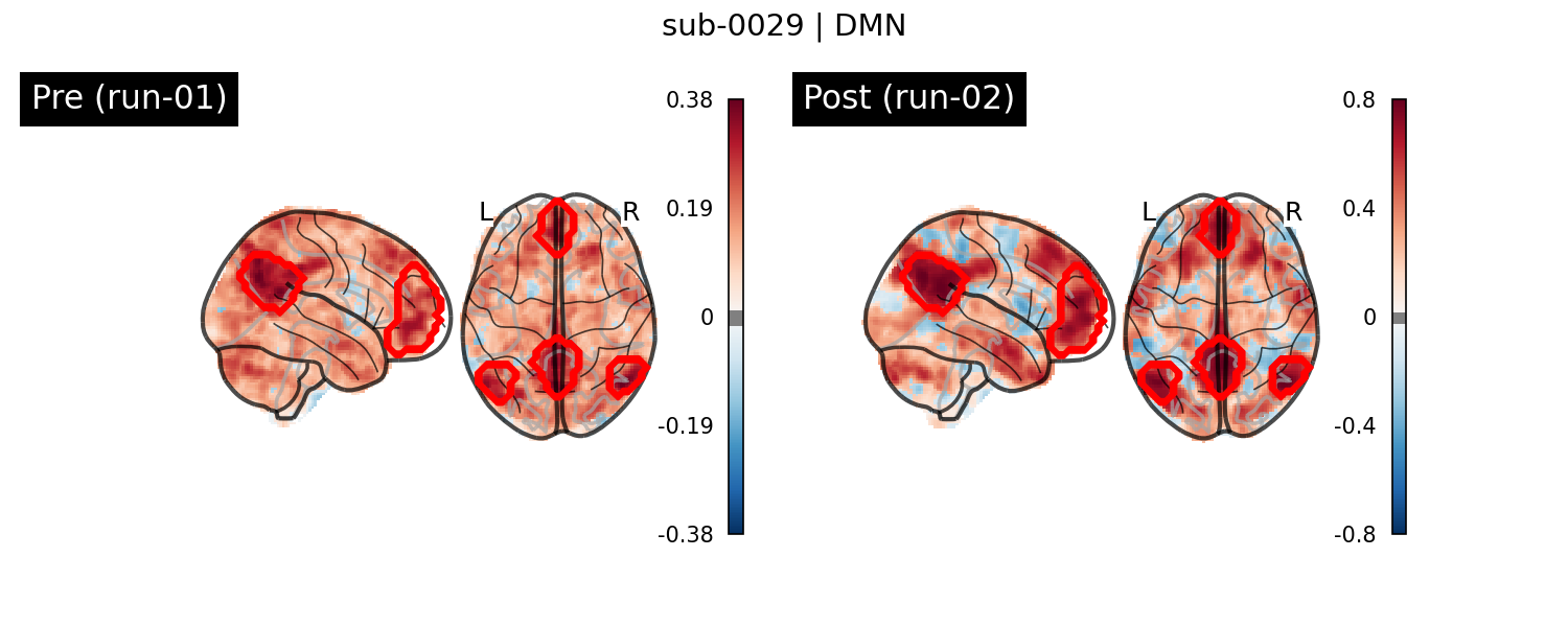 sub-0029_DMN_run-comparison.png