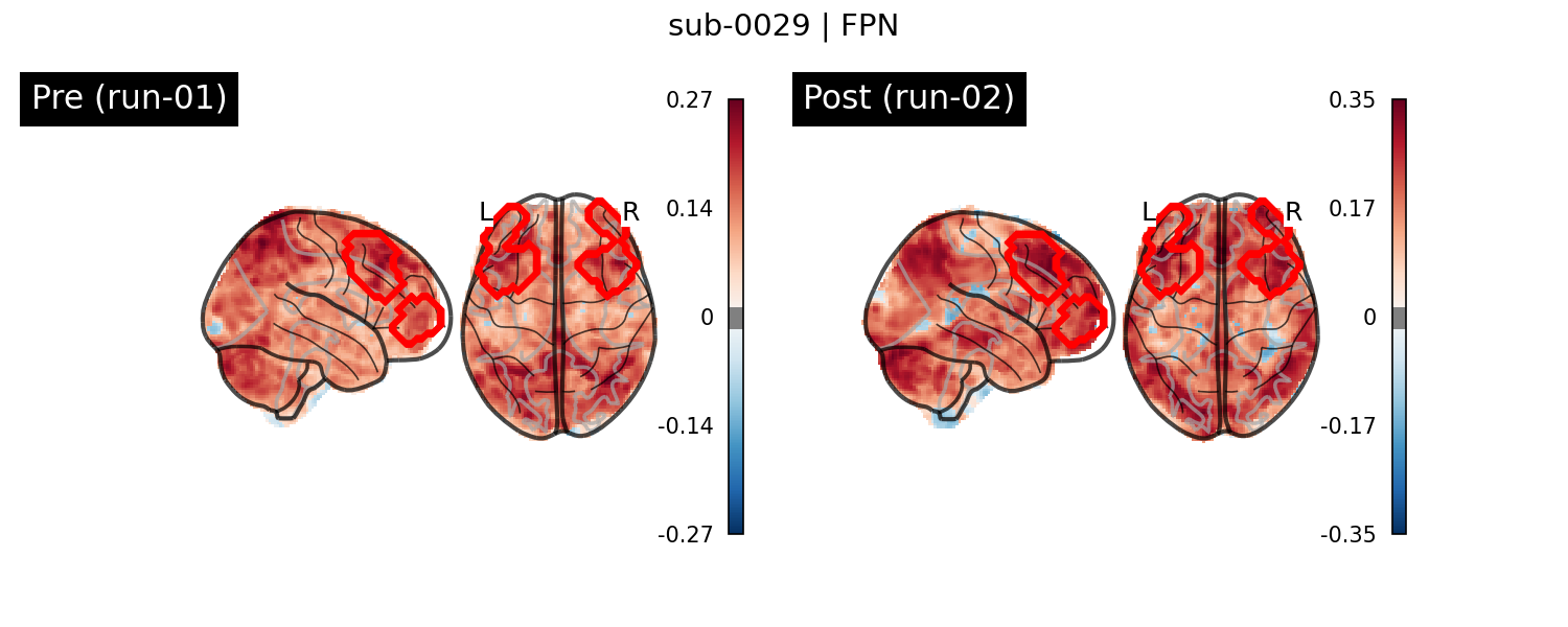 sub-0029_FPN_run-comparison.png