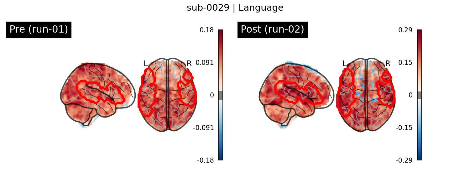 sub-0029_Language_run-comparison.png