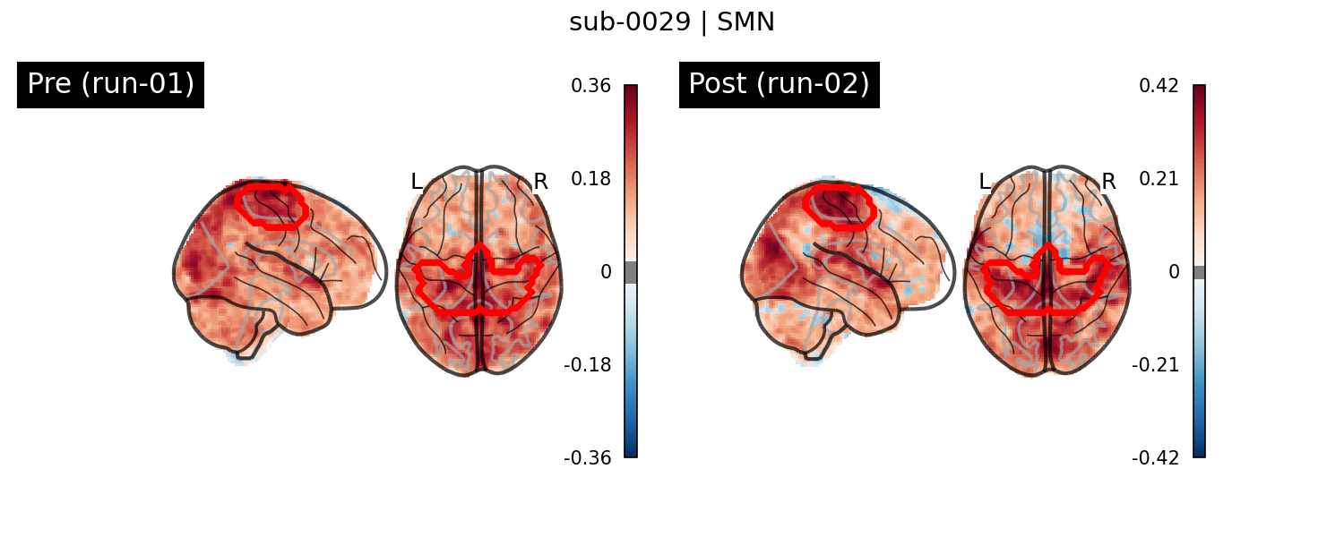 sub-0029_SMN_run-comparison.png