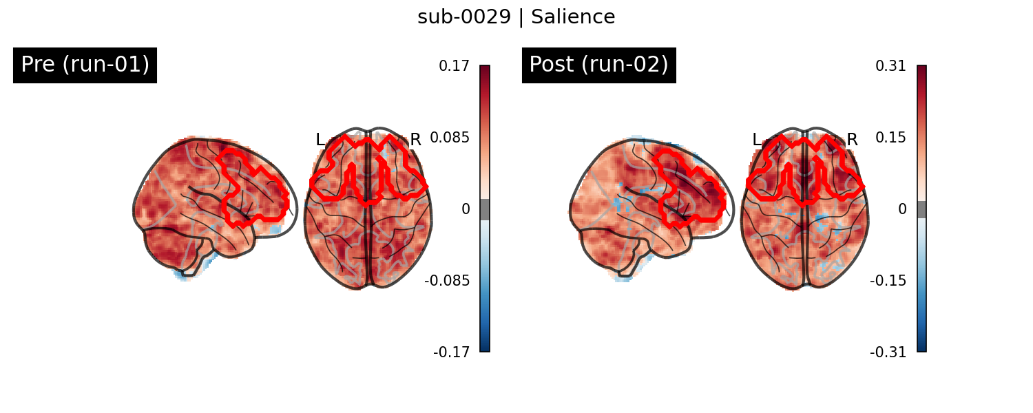 sub-0029_Salience_run-comparison.png