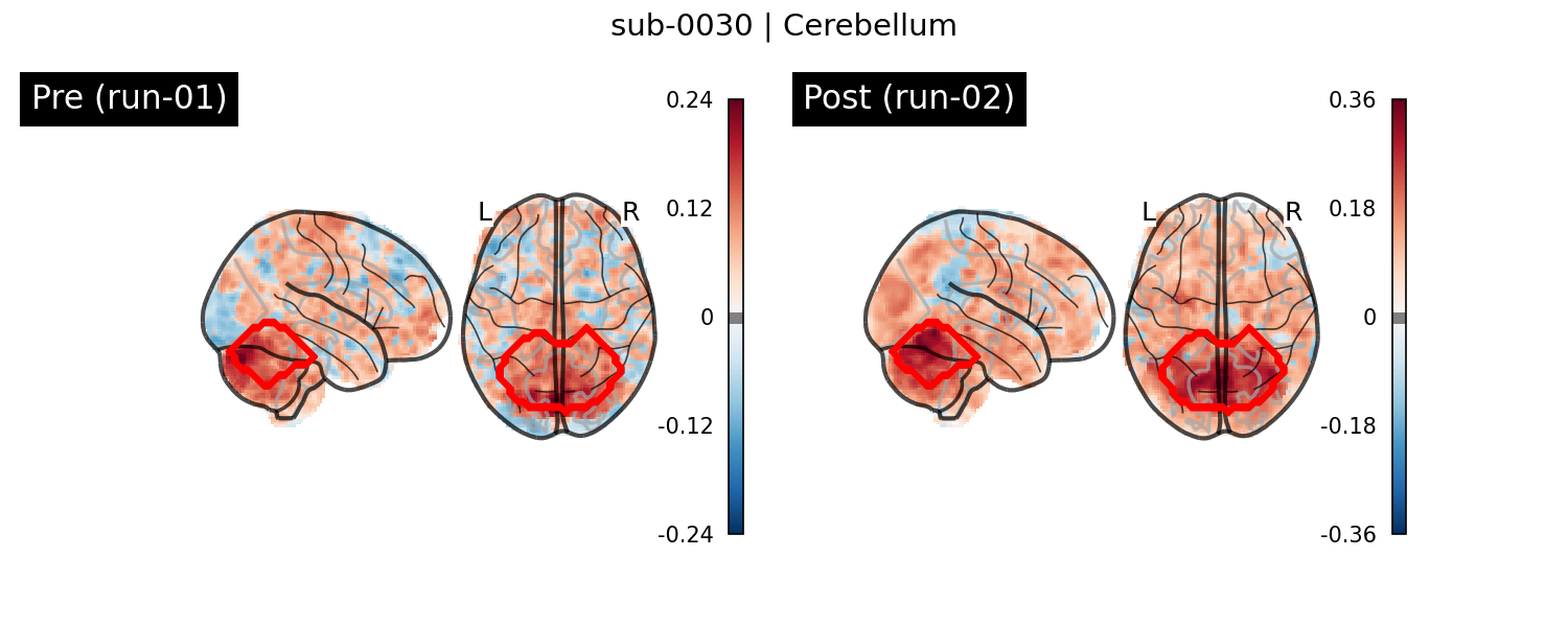 sub-0030_Cerebellum_run-comparison.png