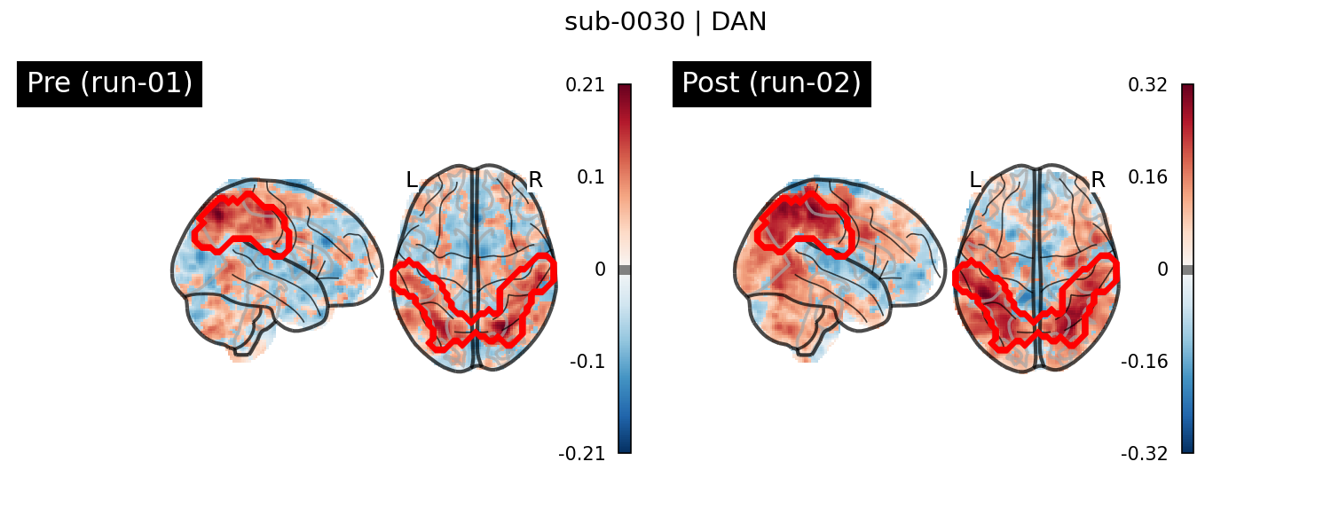 sub-0030_DAN_run-comparison.png