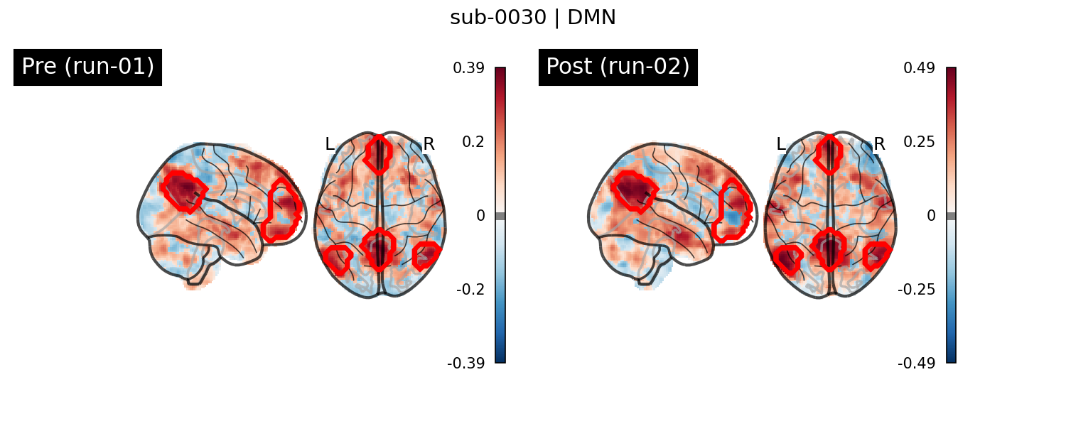 sub-0030_DMN_run-comparison.png