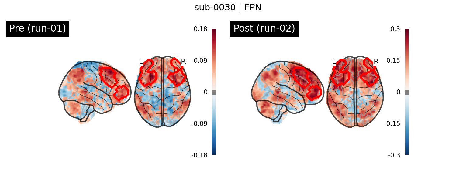 sub-0030_FPN_run-comparison.png