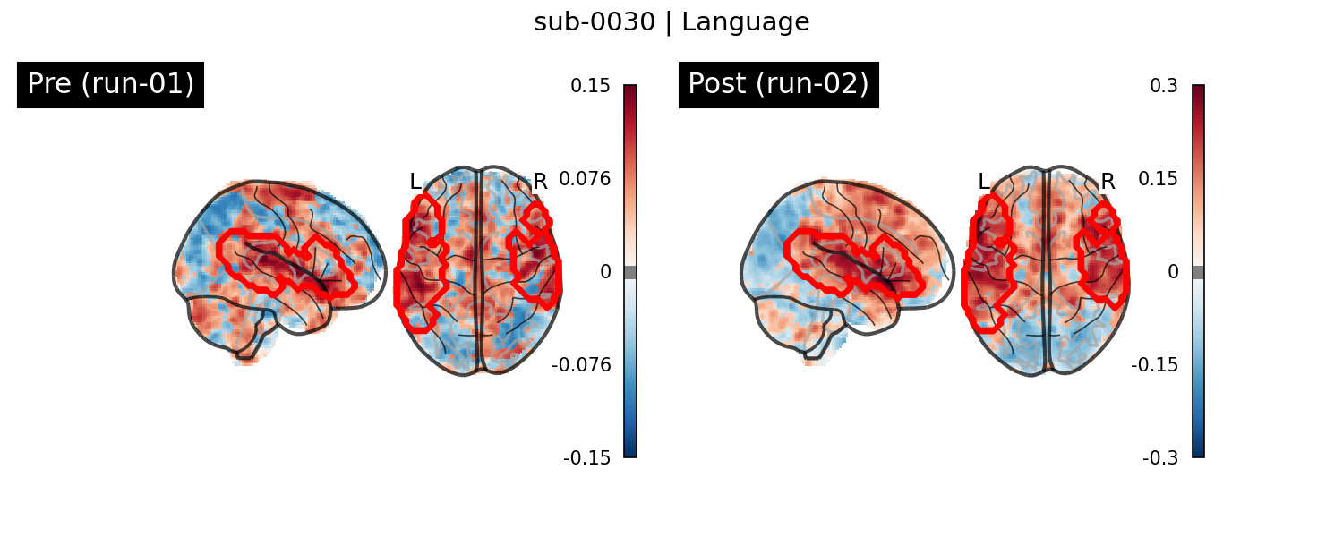 sub-0030_Language_run-comparison.png