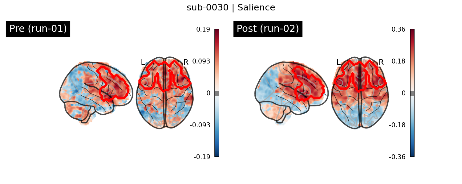 sub-0030_Salience_run-comparison.png