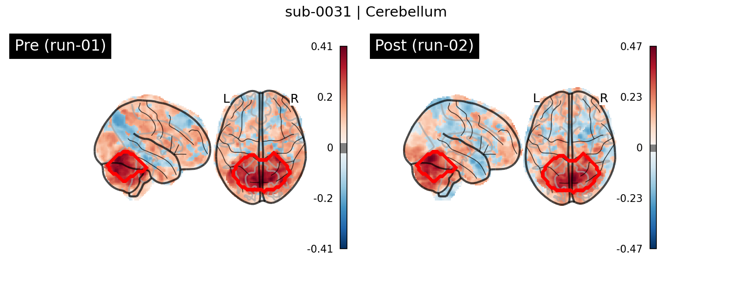 sub-0031_Cerebellum_run-comparison.png