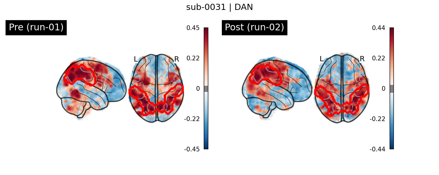 sub-0031_DAN_run-comparison.png