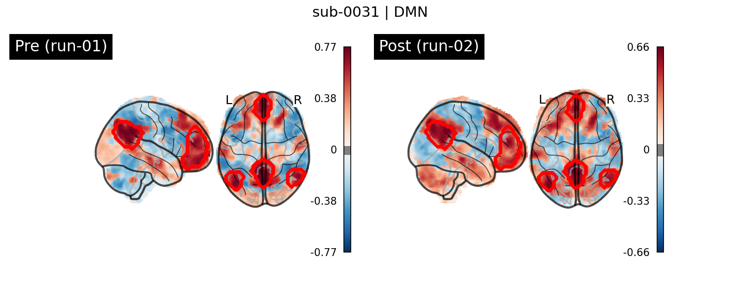 sub-0031_DMN_run-comparison.png