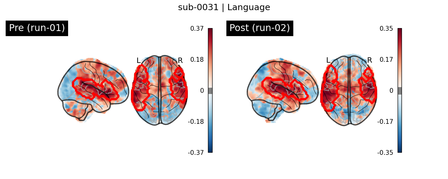 sub-0031_Language_run-comparison.png