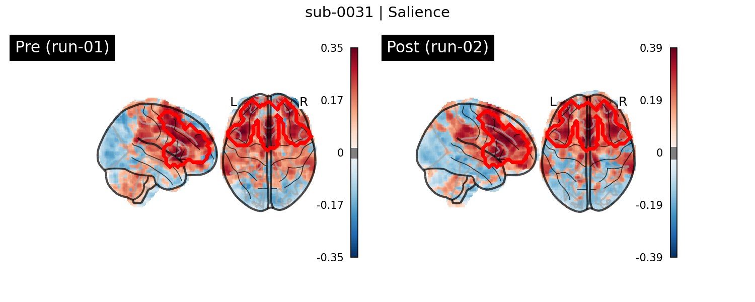 sub-0031_Salience_run-comparison.png