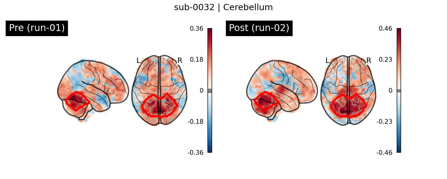 sub-0032_Cerebellum_run-comparison.png