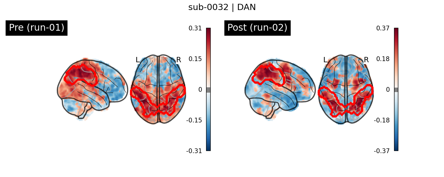 sub-0032_DAN_run-comparison.png