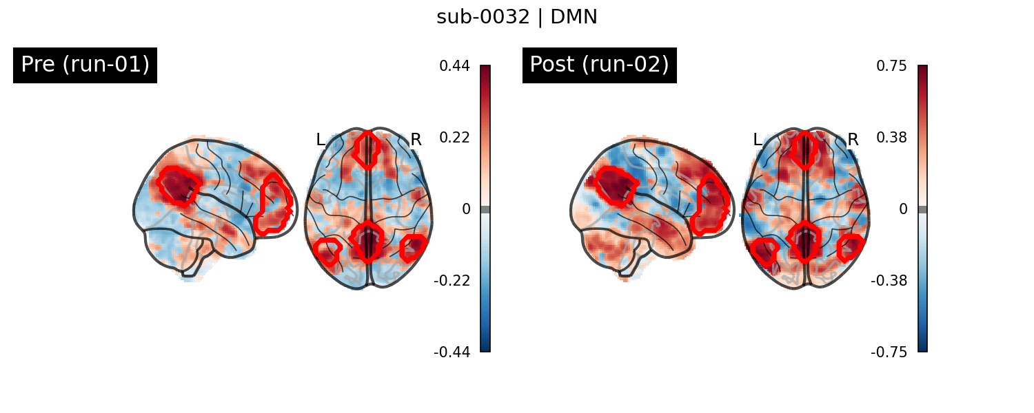 sub-0032_DMN_run-comparison.png