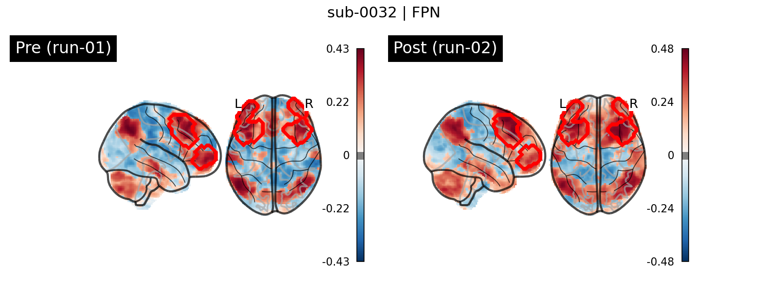 sub-0032_FPN_run-comparison.png