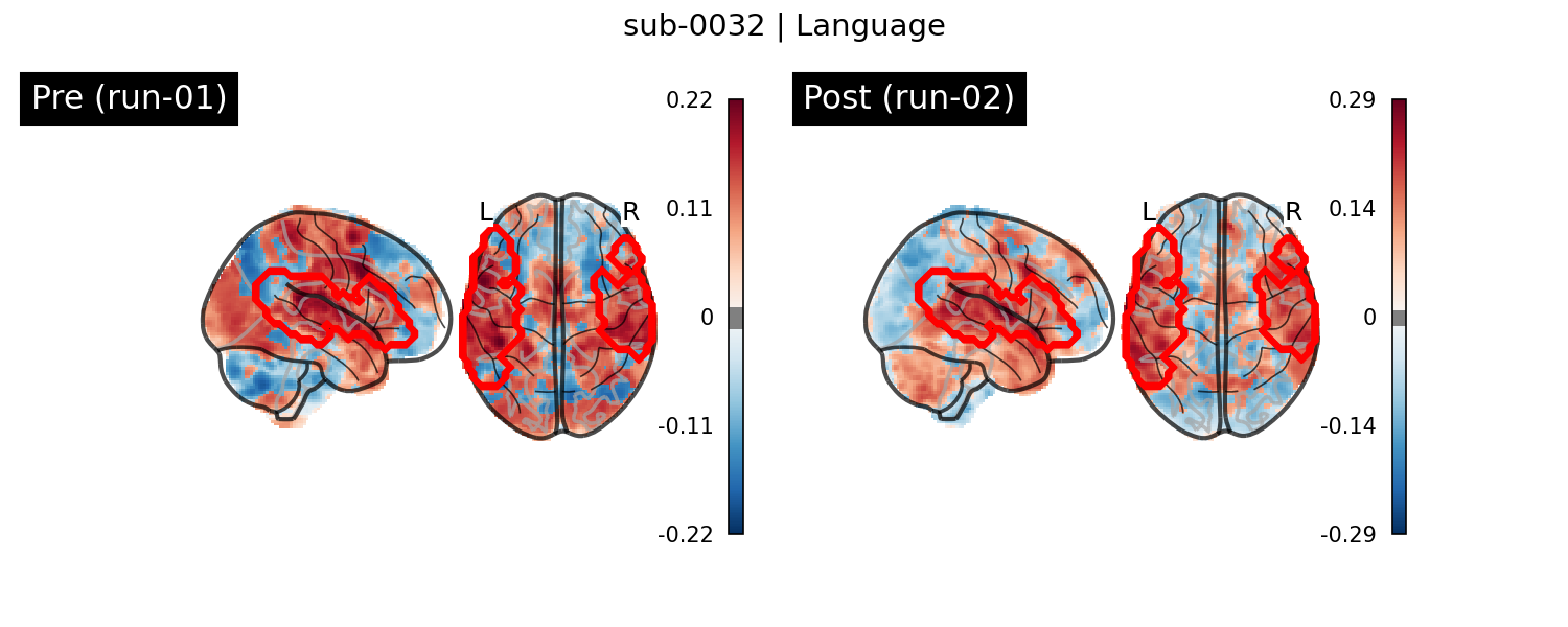 sub-0032_Language_run-comparison.png