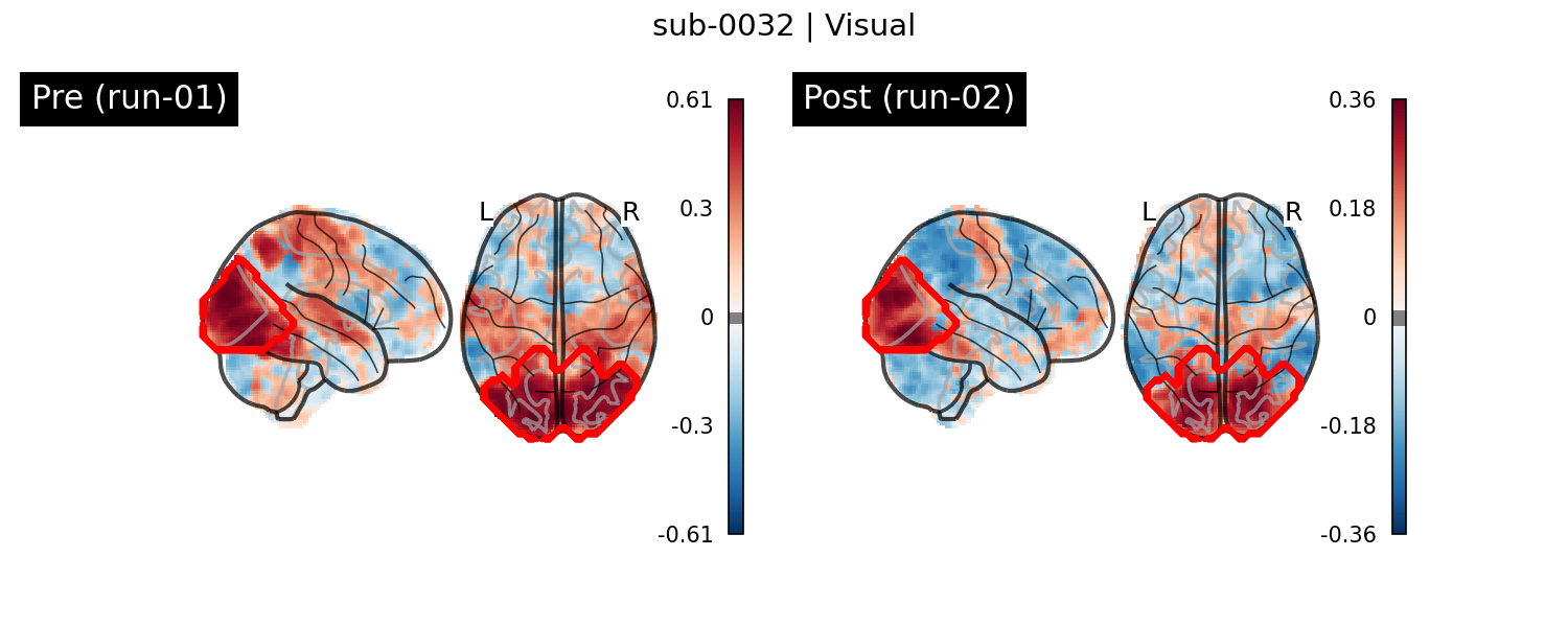 sub-0032_Visual_run-comparison.png