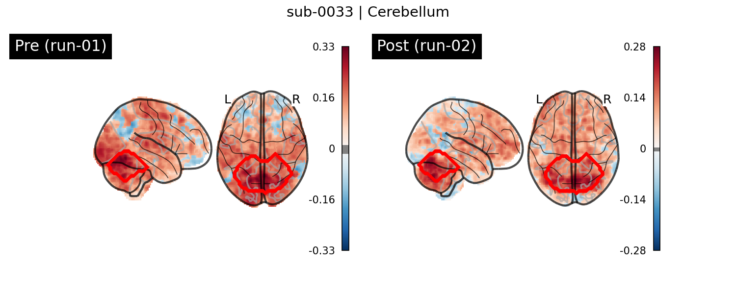 sub-0033_Cerebellum_run-comparison.png