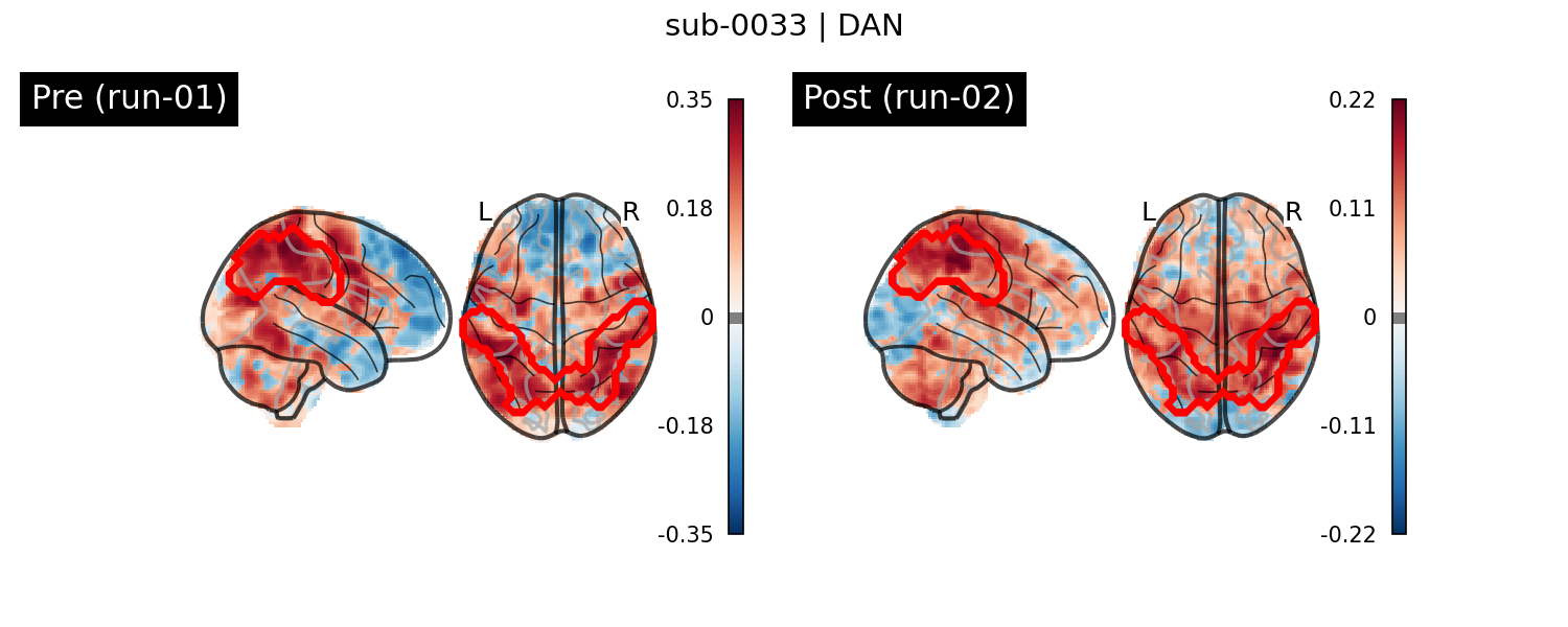 sub-0033_DAN_run-comparison.png
