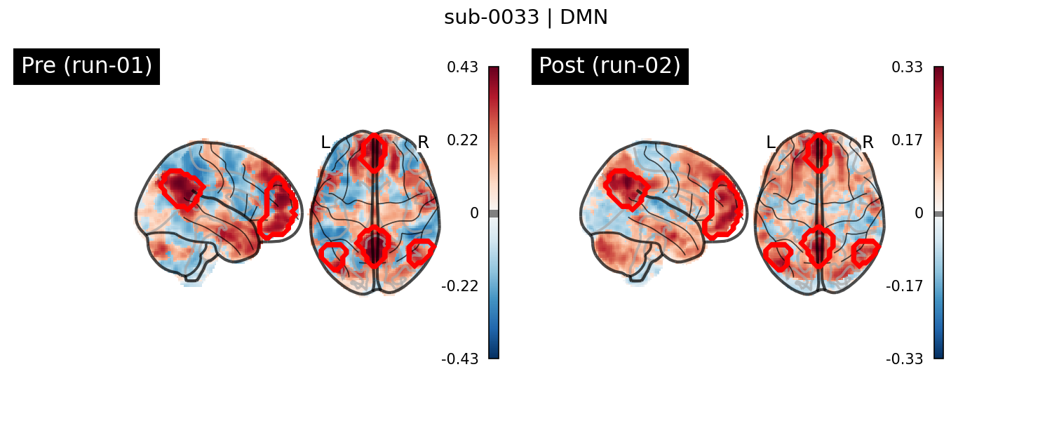 sub-0033_DMN_run-comparison.png