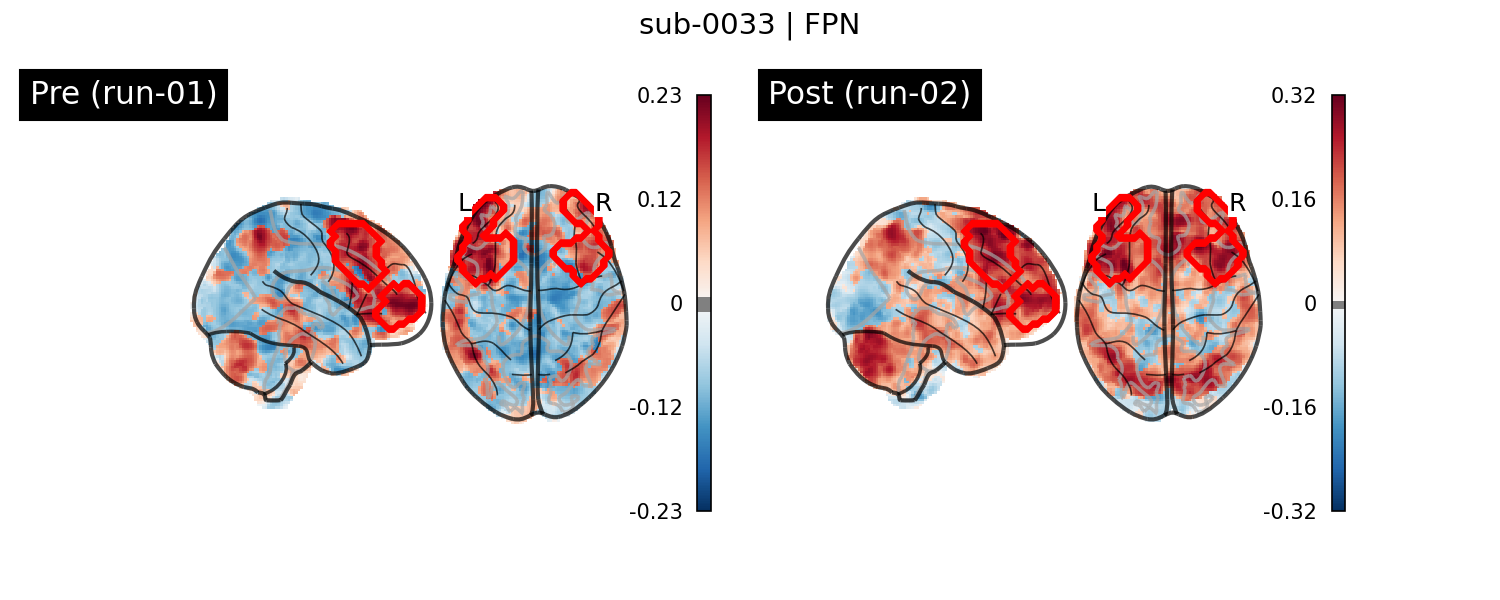 sub-0033_FPN_run-comparison.png