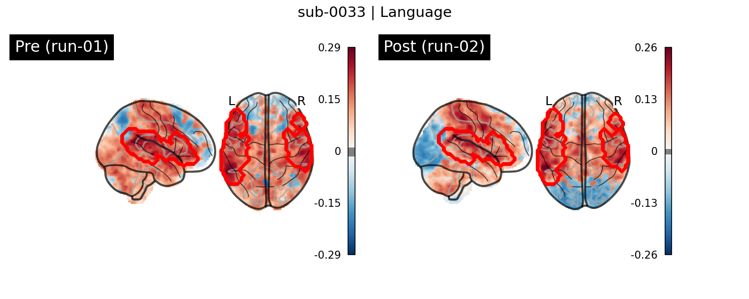 sub-0033_Language_run-comparison.png