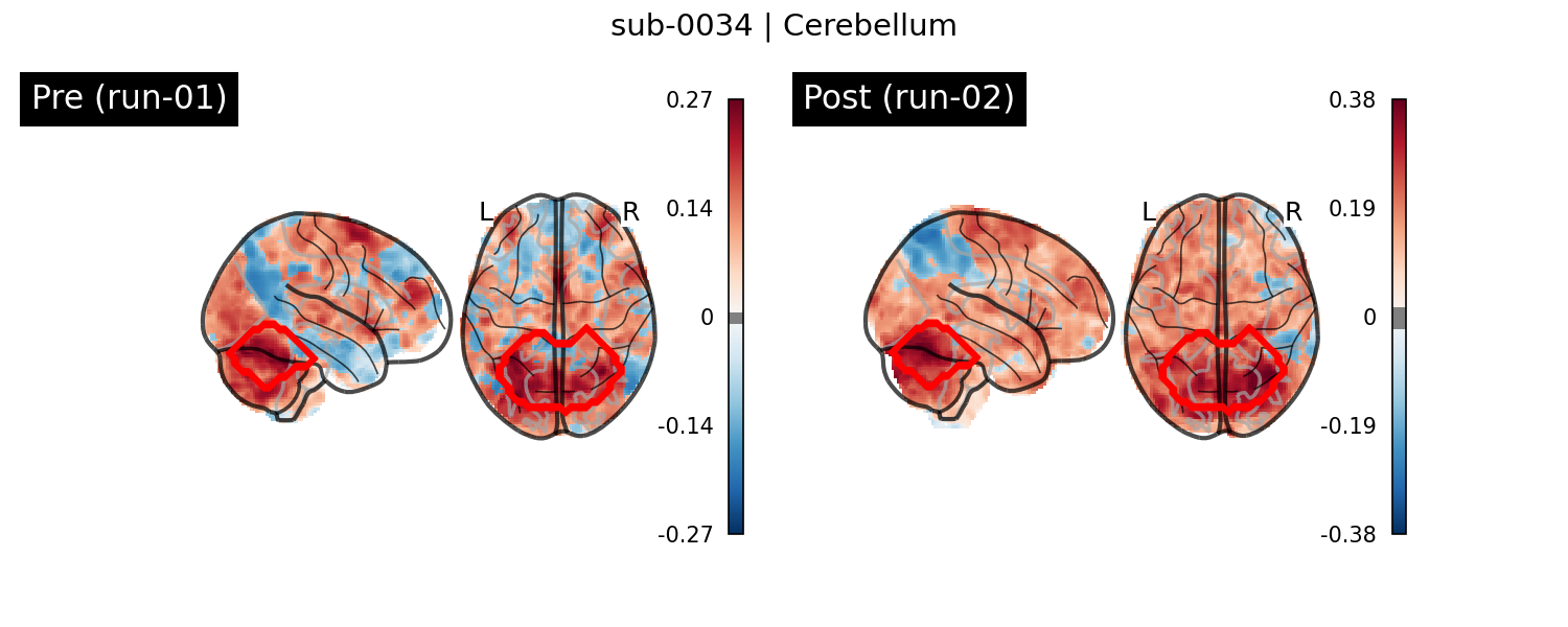 sub-0034_Cerebellum_run-comparison.png