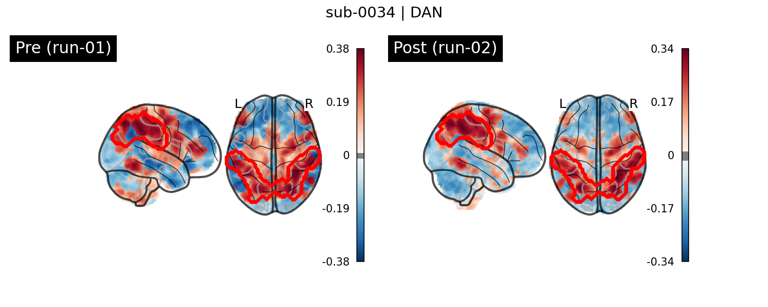 sub-0034_DAN_run-comparison.png