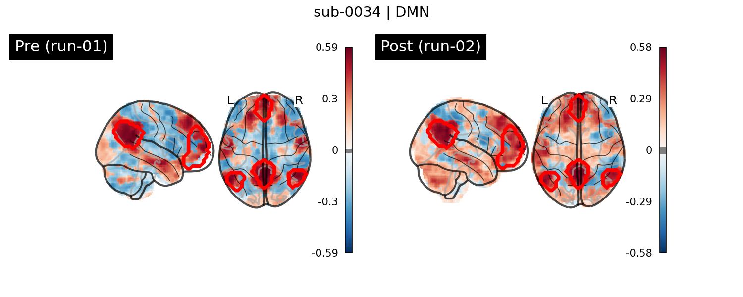 sub-0034_DMN_run-comparison.png