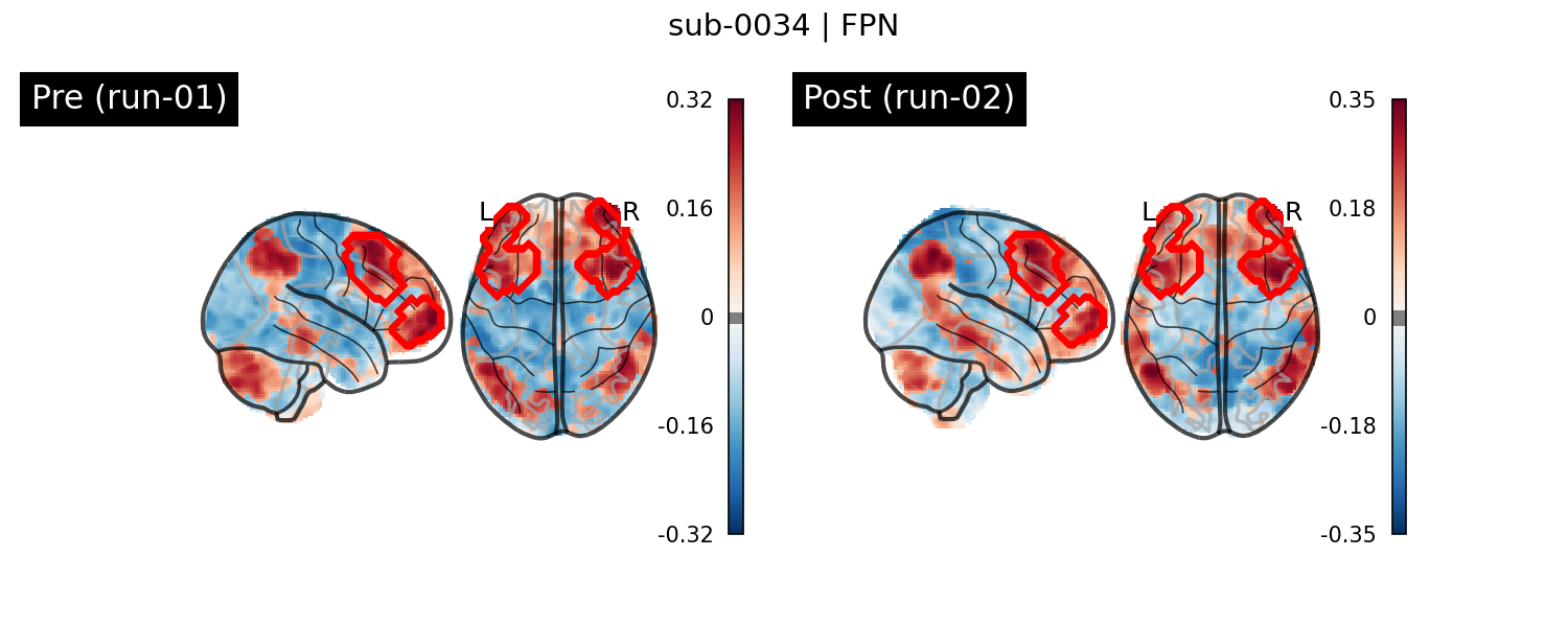 sub-0034_FPN_run-comparison.png