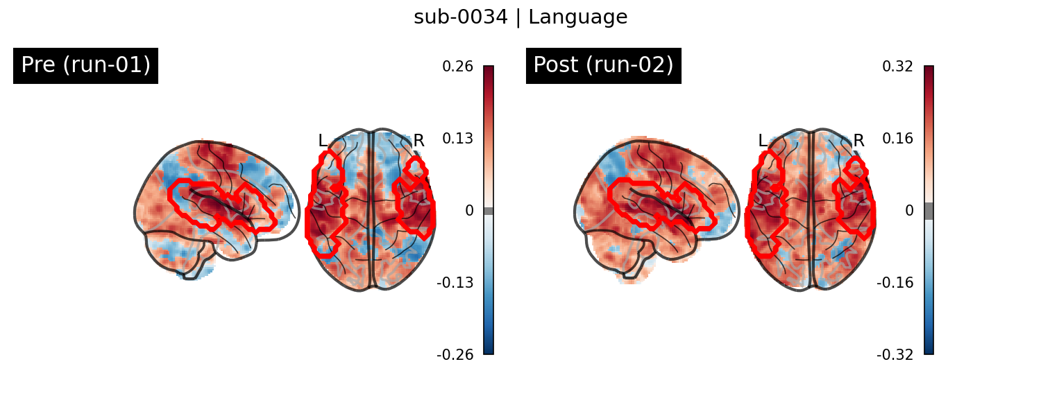 sub-0034_Language_run-comparison.png