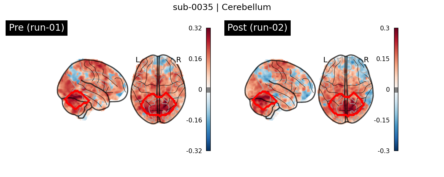 sub-0035_Cerebellum_run-comparison.png