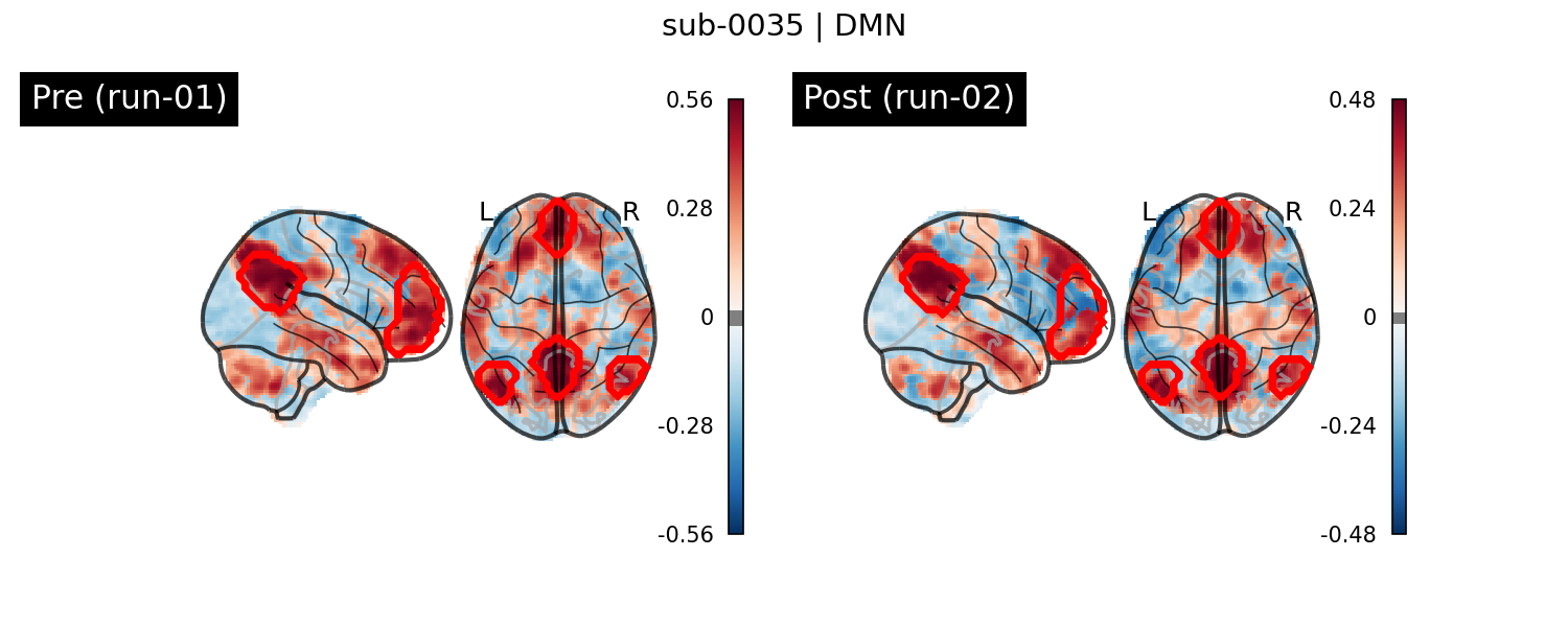 sub-0035_DMN_run-comparison.png