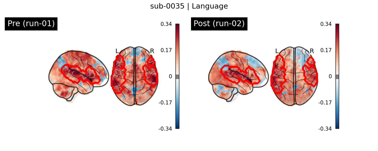 sub-0035_Language_run-comparison.png