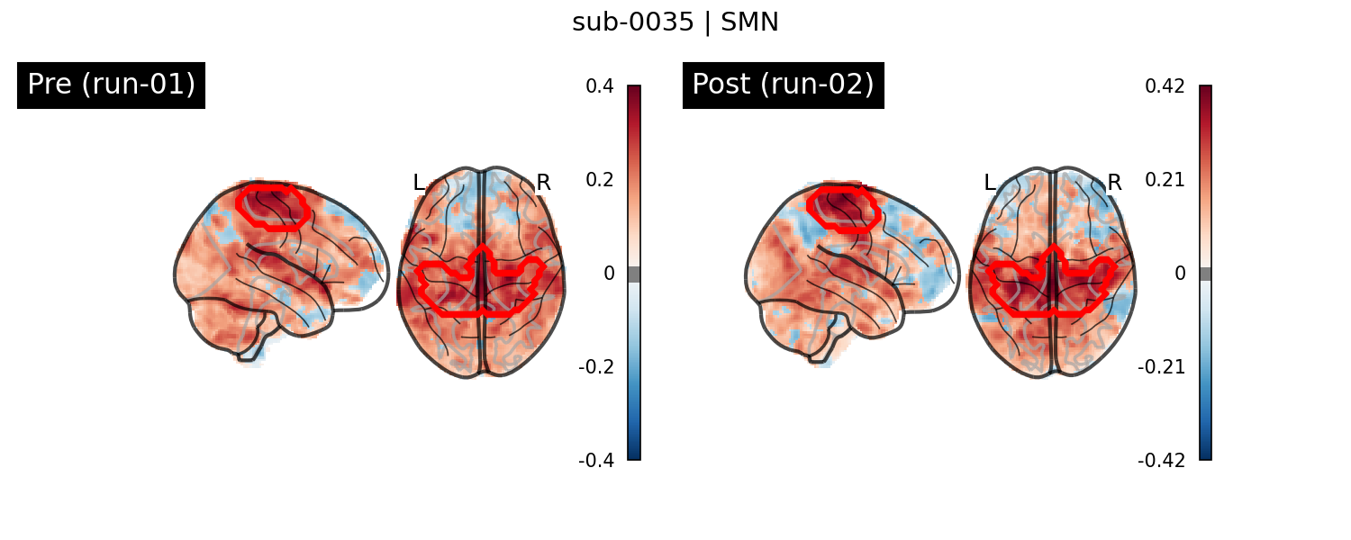 sub-0035_SMN_run-comparison.png